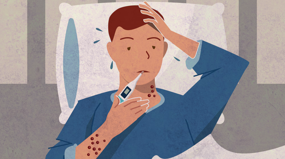Illustration of a man sick in bed with a thermometer in his mouth and rash on his arm