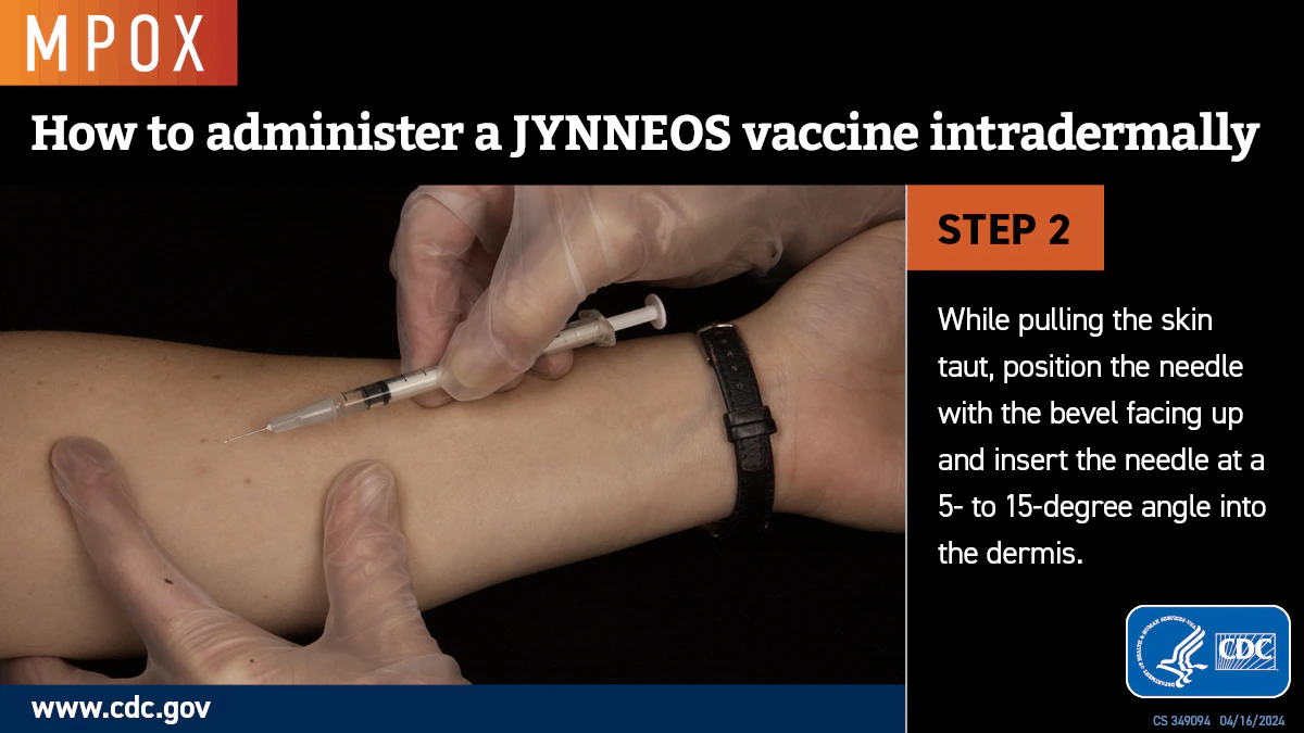 Intradermal Injection Step 2a A photo of a gloved hand inserting a needle into a forearm.