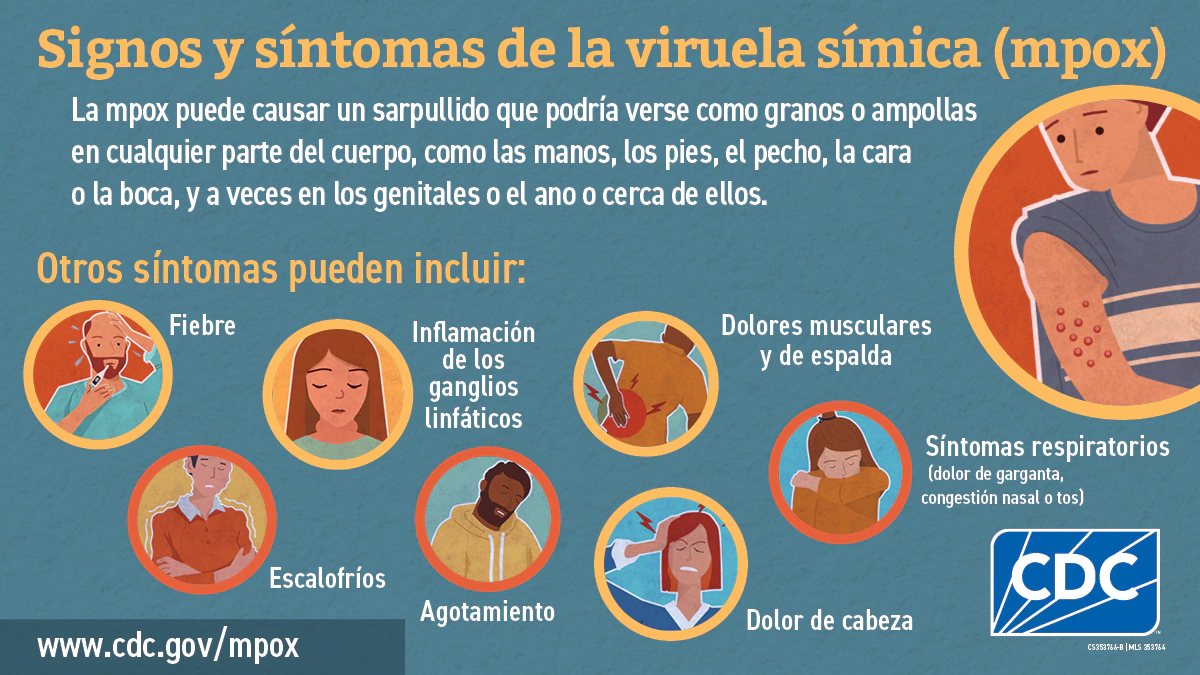 Social media graphic signs & symptoms in Spanish Infographic in Spanish: Signos y síntomas de la viruela símica (mpox)