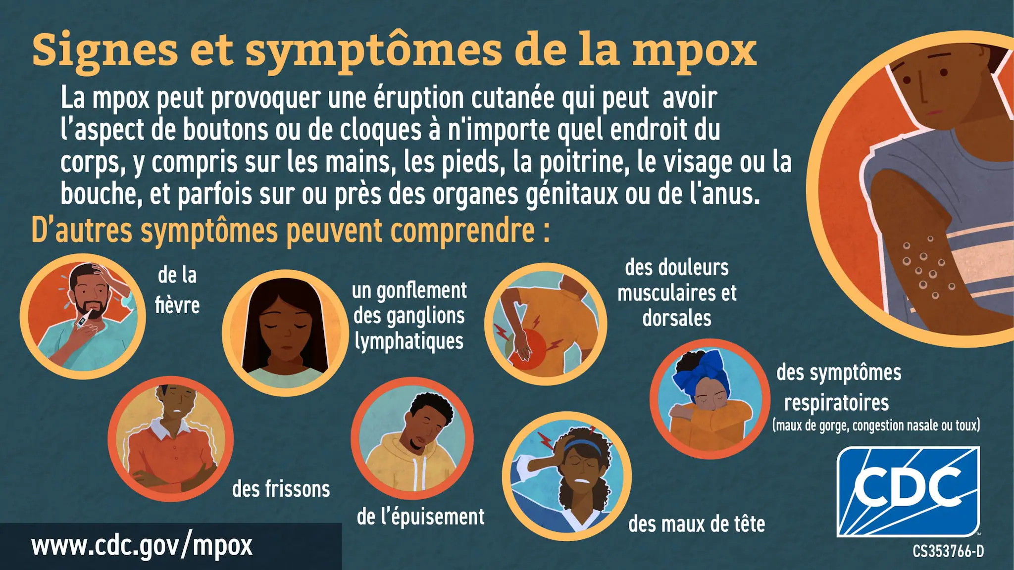 Social media graphic signs & symptoms in French for African audience Infographic: Signes et symptômes de la mpox