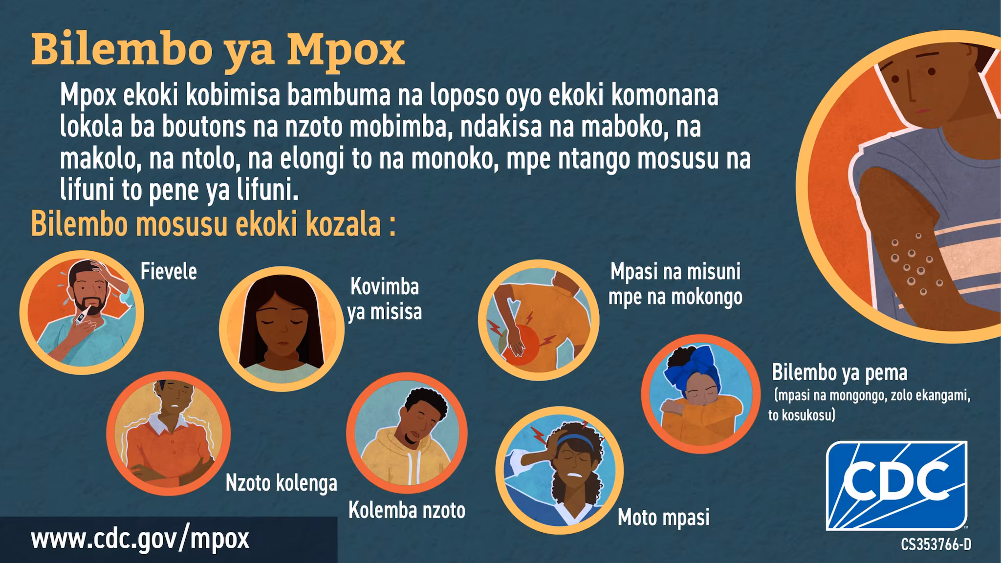 Social media graphic signs & symptoms in Lingala for African audience Infographic: Bilembo ya Mpox
