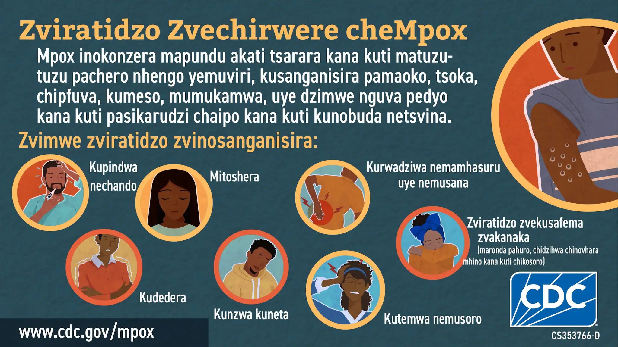 Social media graphic signs & symptoms in Shona for African audience Infographic: Zviratidzo Zvechirwere cheMpox