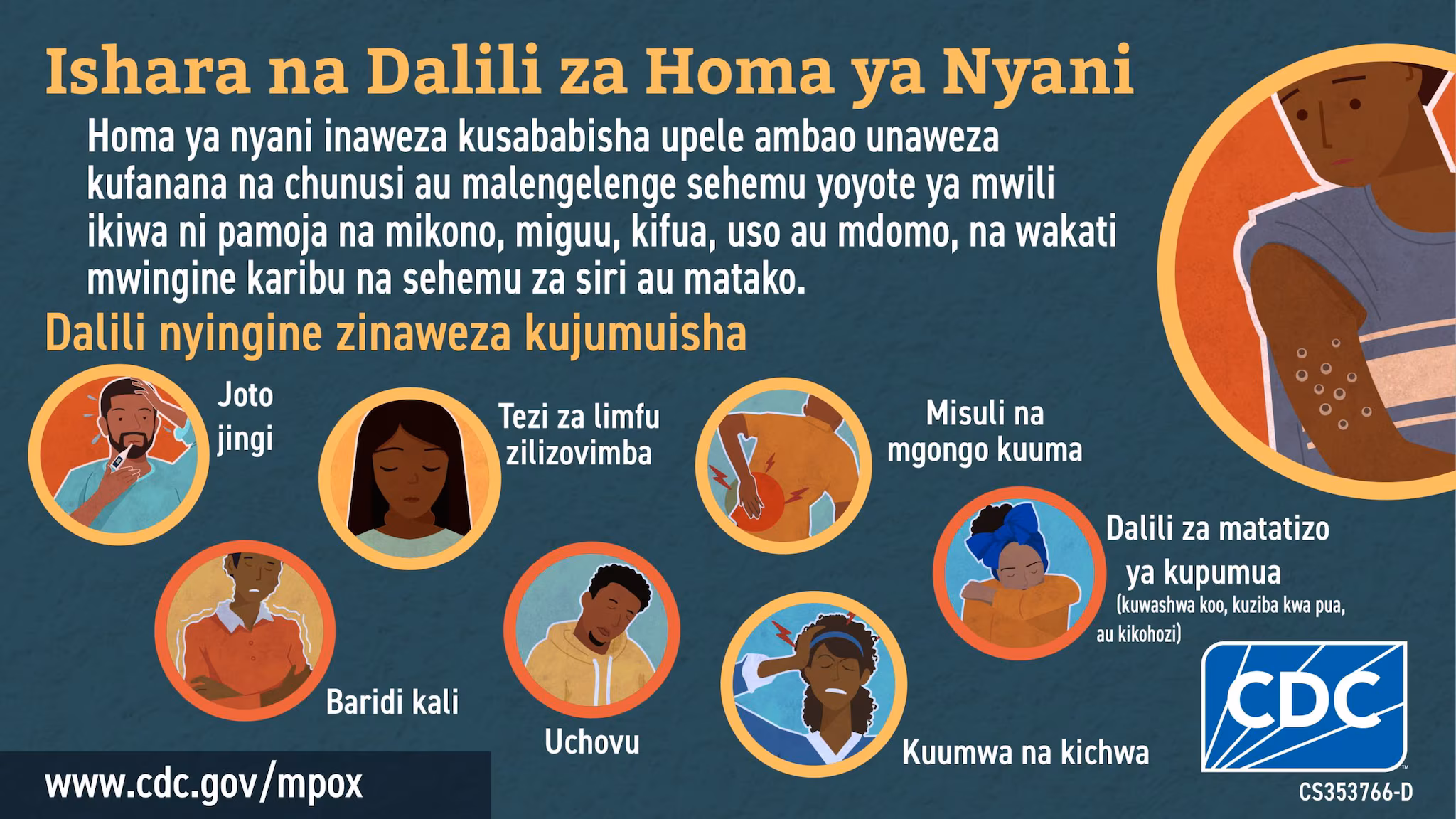 Social media graphic signs & symptoms in Swahili for African audience Infographic: Ishara na Dalili za Homa ya Nyani