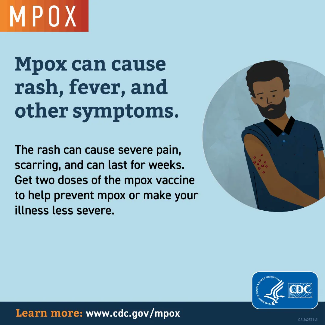 mpox-vax-serious-disease-1-1080x1080 Infographic: Mpox can cause rash, fever, and other symptoms