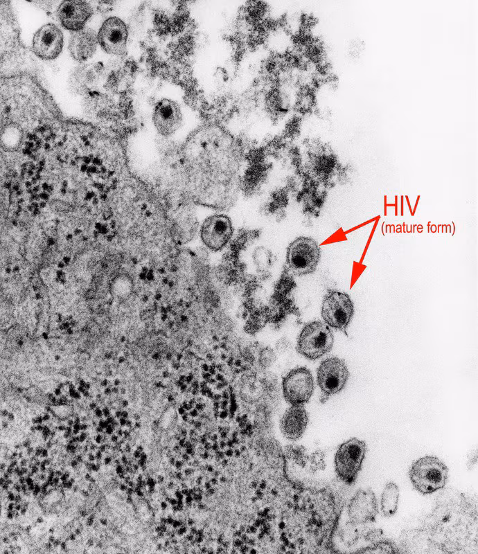hiv-micrograph