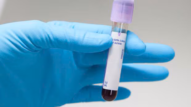 Image of gloved hands holding a vile containing blood.