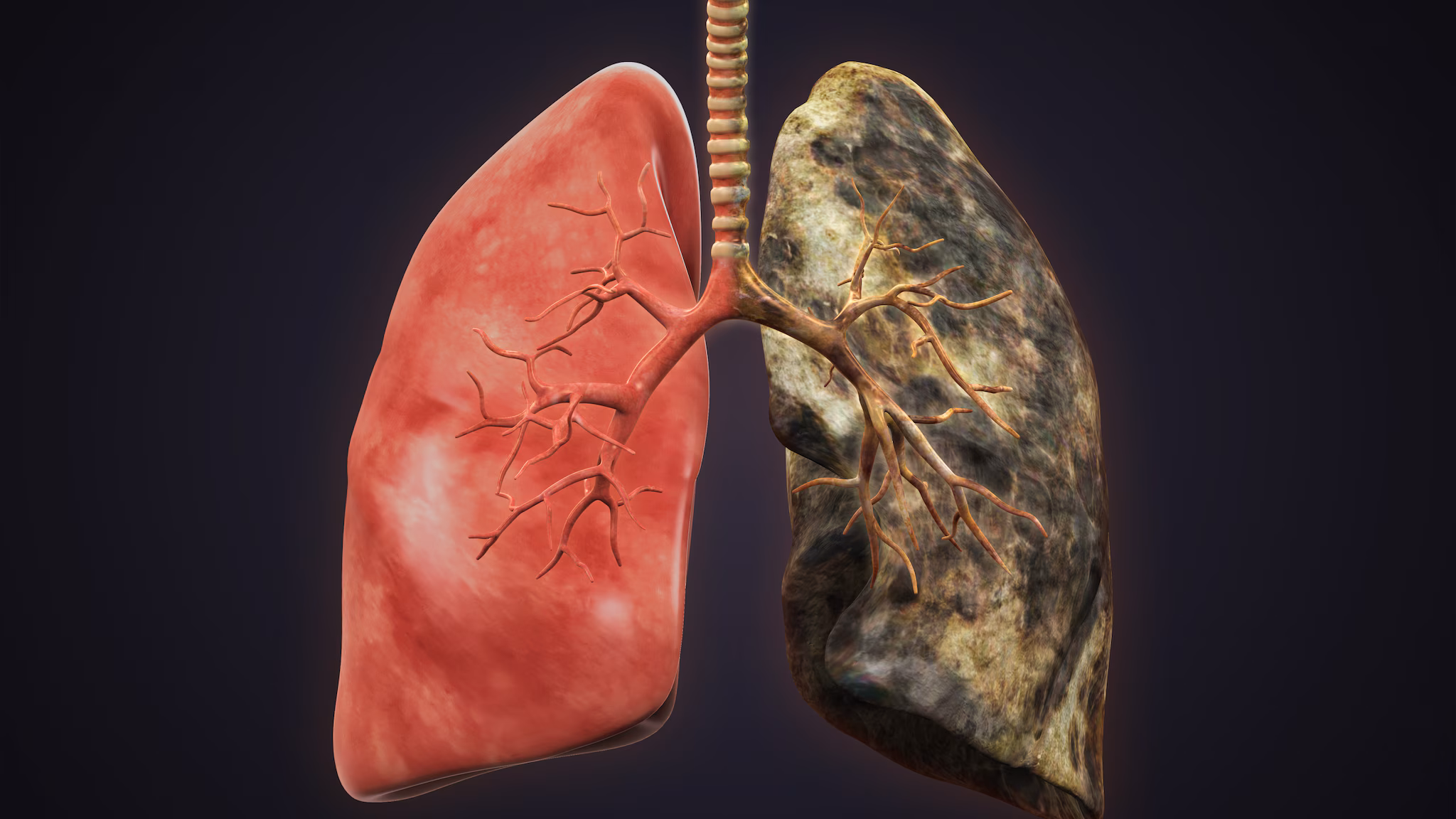 Picture of a healthy lung on one side and black lung on the other.
