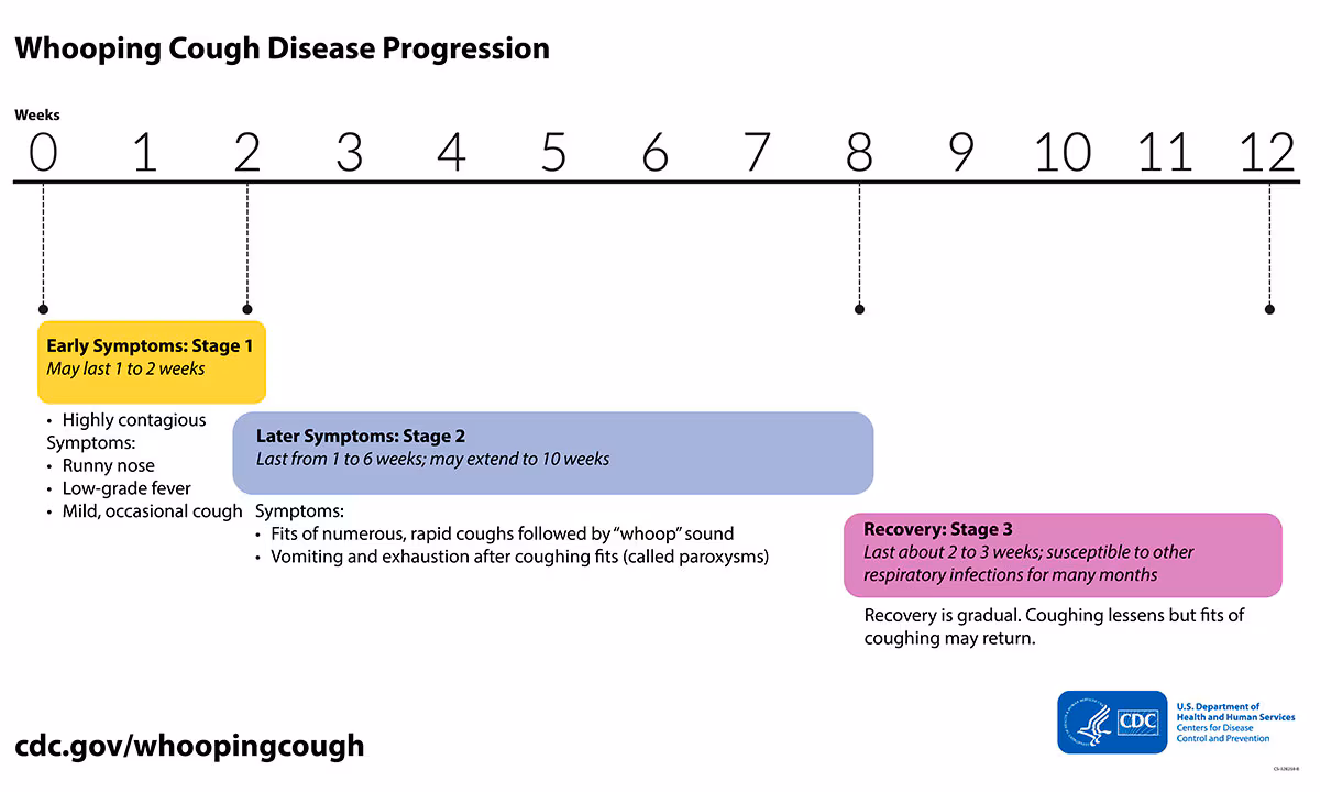 Pertussistimeline.jpg Timeline of whooping cough disease progression.