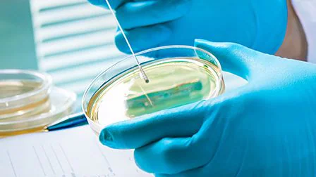 Culture testing in lab setting Culture testing in lab setting