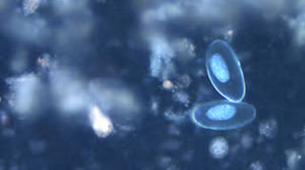 Eggs of E. vermicularis viewed under UV microscopy.