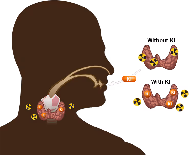 vector graphic showing where KI goes in the body