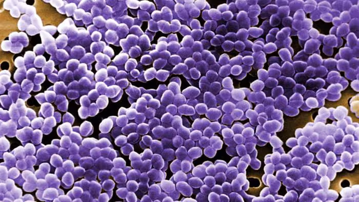 This digitally colorized scanning electron microscopic image depicted large numbers of Gram-positive, Enterococcus sp. bacteria.