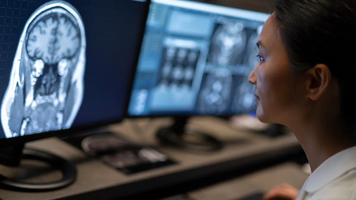 Stroke Facts Health care worker reviewing brain scans on a computer monitor