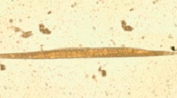 — title missing — Adult free-living female S. stercoralis.