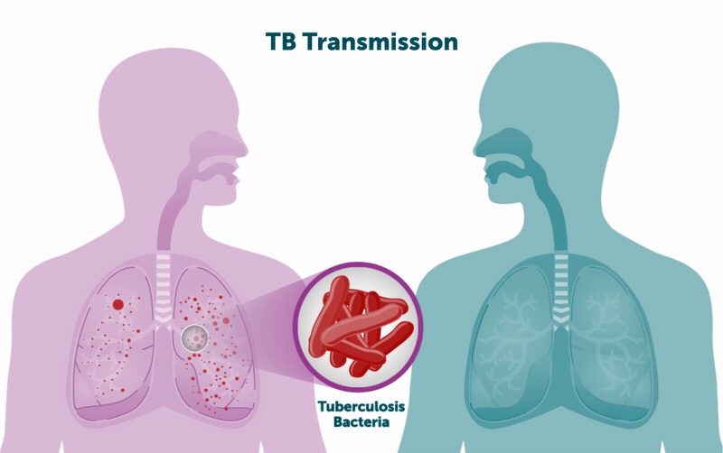 Tuberculosis Transmission An animated shows TB germs spreading from one person to another