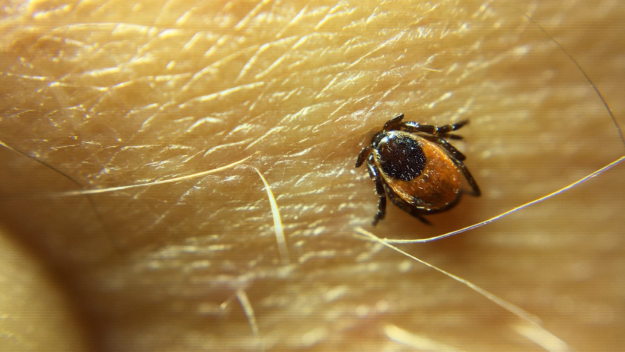 Blacklegged tick attached to skin