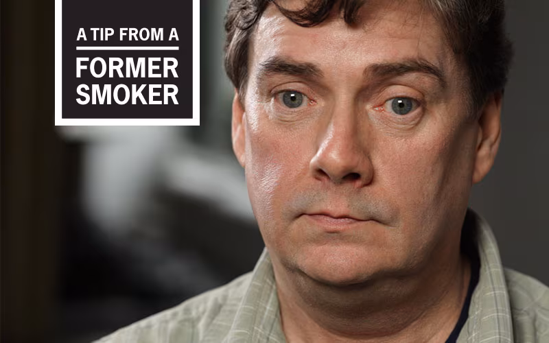 Brett’s “Tooth Loss Isn’t Pretty” Story - A Tip From a Former Smoker