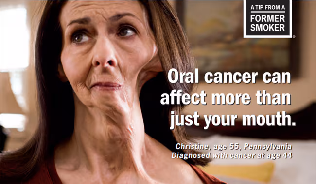 Christine's Tips: Oral Cancer