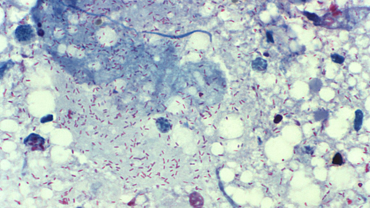 Rickettsia rickettsii bacteria Rickettsia rickettsii bacteria, PHIL 10953