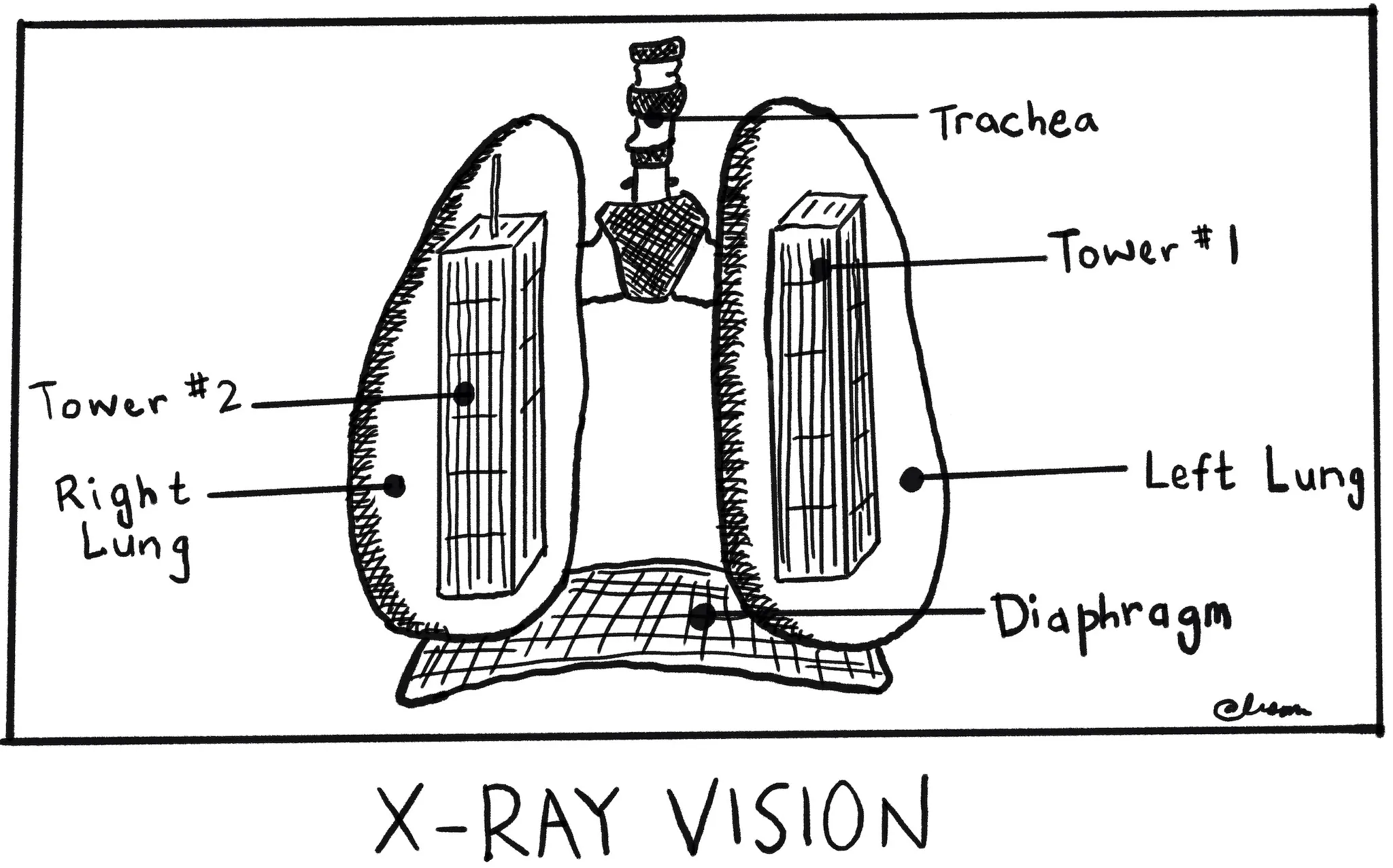 Cartoon reproduction of lungs created and provided by Ali Shapiro,
								former Stuyvesant High School Student.