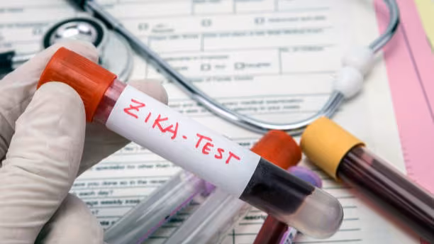 — title missing — Lab worker holding a tube of blood labelled, "Zika Test"